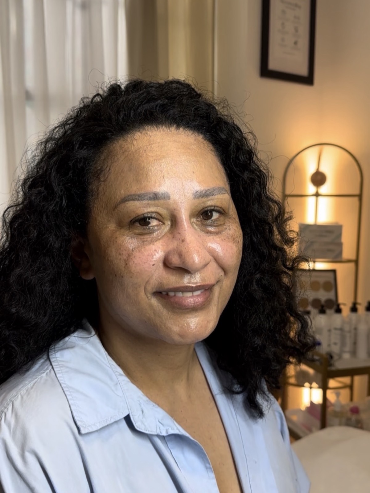 Clinician delivering a polynucleotide treatment at Melatone Skin Clinic, Battersea
